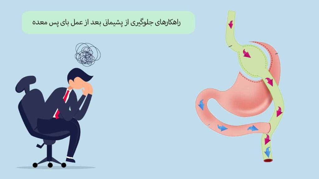 راهکارهای جلوگیری از پشیمانی بعد از عمل بای پس معده