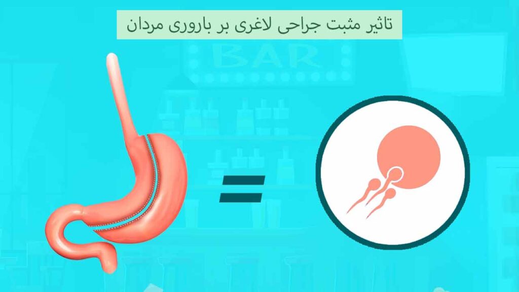 تاثیر مثبت جراحی لاغری بر باروری مردان