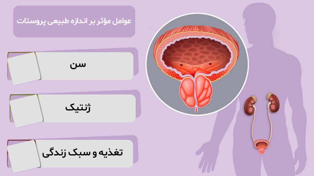 عوامل مؤثر بر اندازه طبیعی پروستات