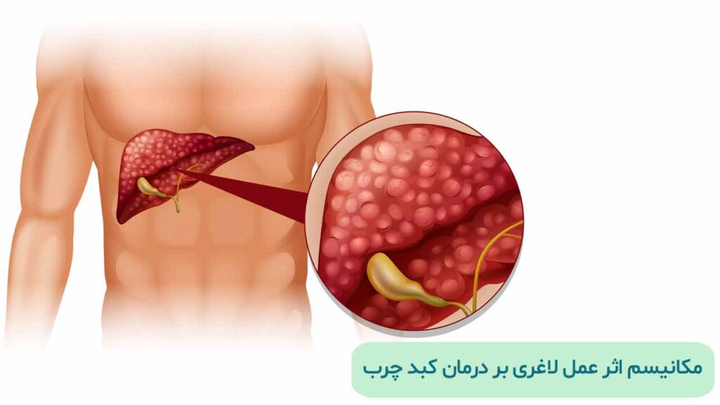 مکانیسم اثر عمل لاغری بر درمان کبد چرب