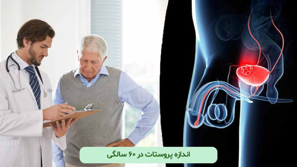 اندازه پروستات در ۶۰ سالگی