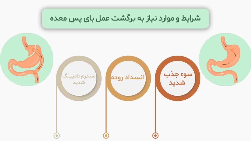 شرایط و موارد نیاز به برگشت عمل بای پس معده