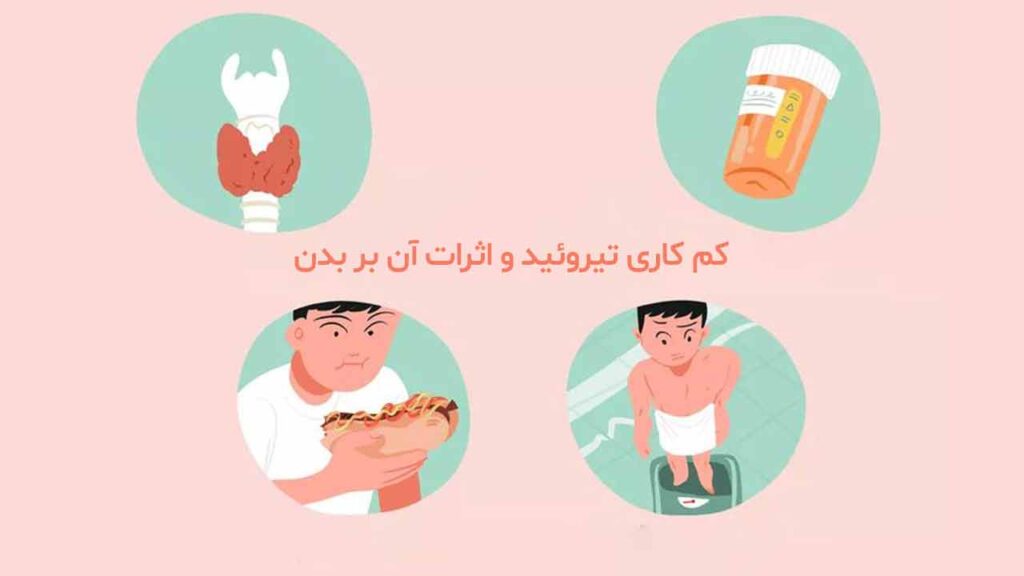 کم کاری تیروئید و اثرات آن بر بدن