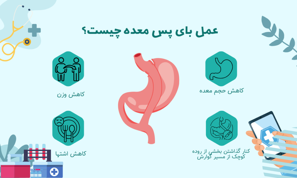 عمل بای پس معده چیست؟