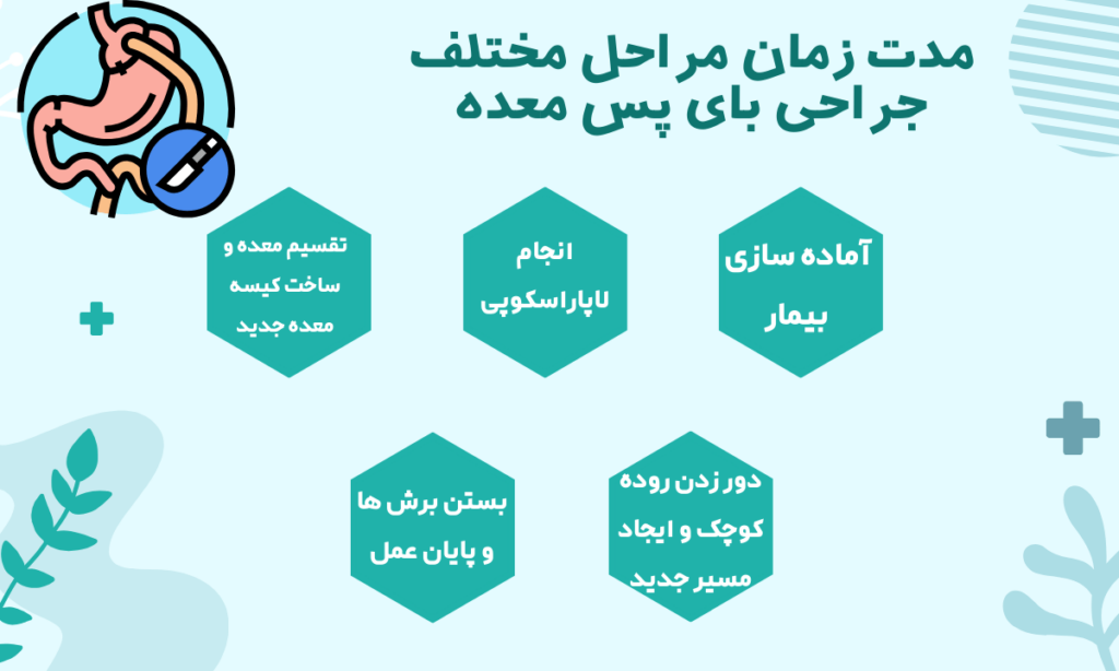 مدت زمان مراحل مختلف جراحی بای پس معده