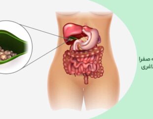ارتباط سنگ کیسه صفرا با جراحی لاغری