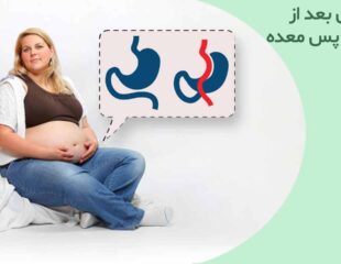 بارداری بعد از عمل بای پس معده