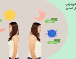 تغییرات هورمونی بعد از عمل اسلیو