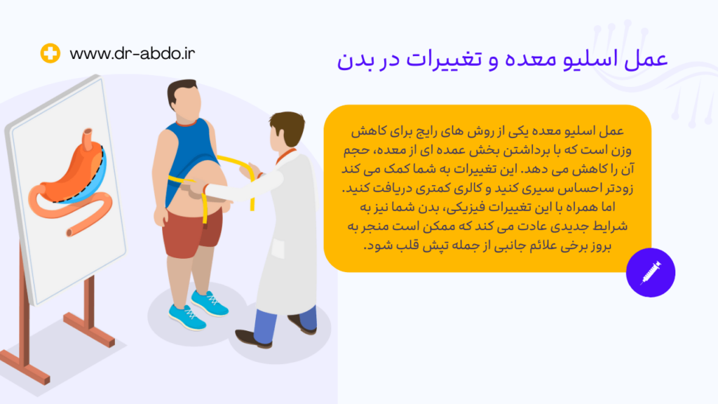 عمل اسلیو معده و تغییرات در بدن