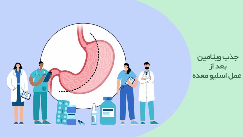 جذب ویتامین بعد از عمل اسلیو معده