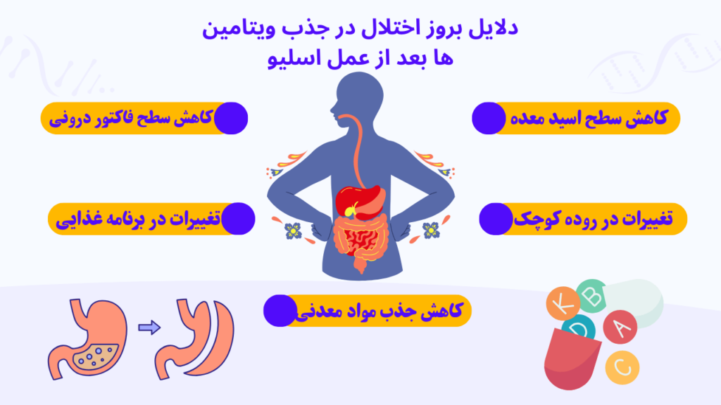 دلایل بروز اختلال در جذب ویتامین ها بعد از عمل اسلیو