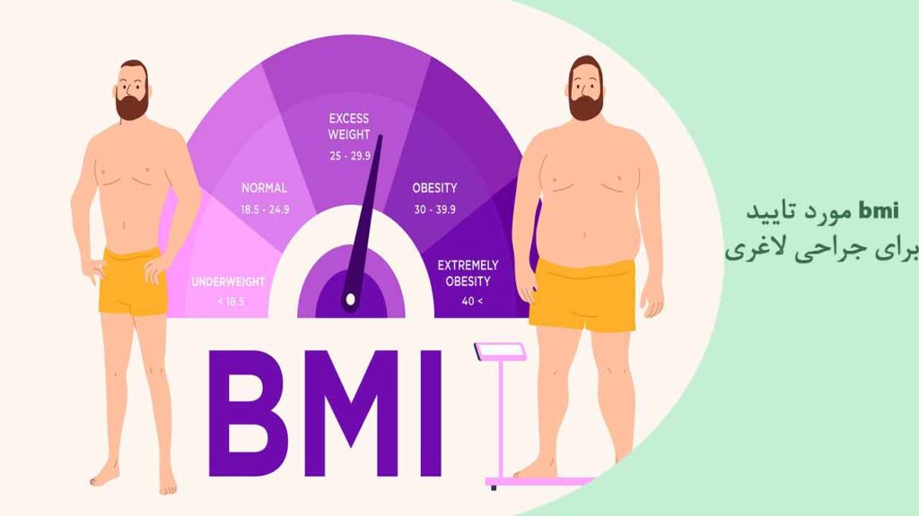 bmi مورد تایید برای جراحی لاغری