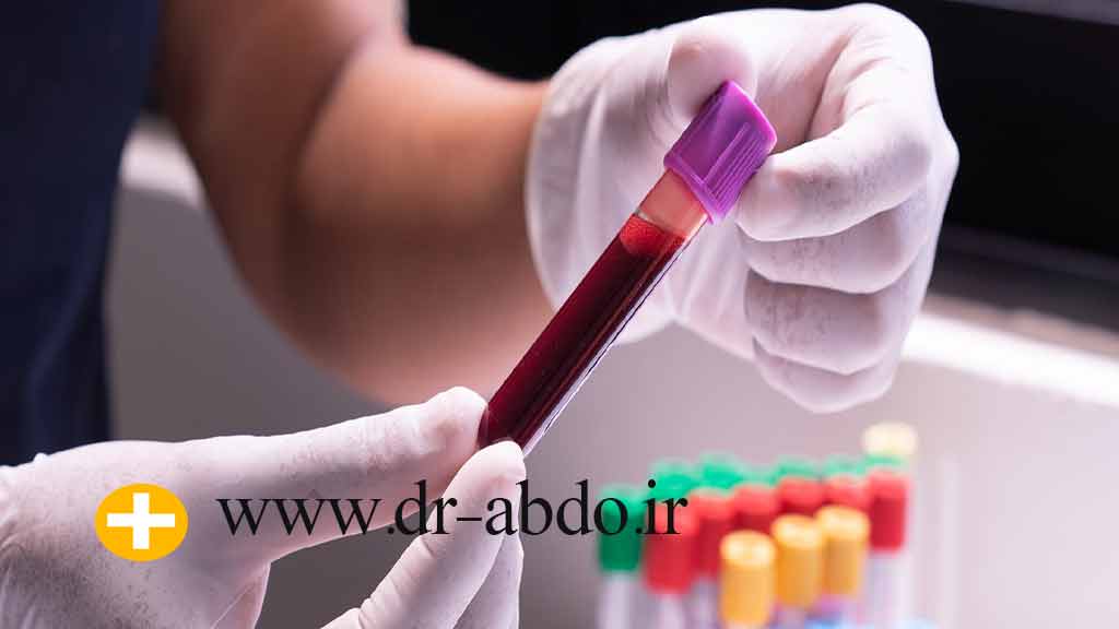 آزمایش های ضروری قبل از عمل اسلیو